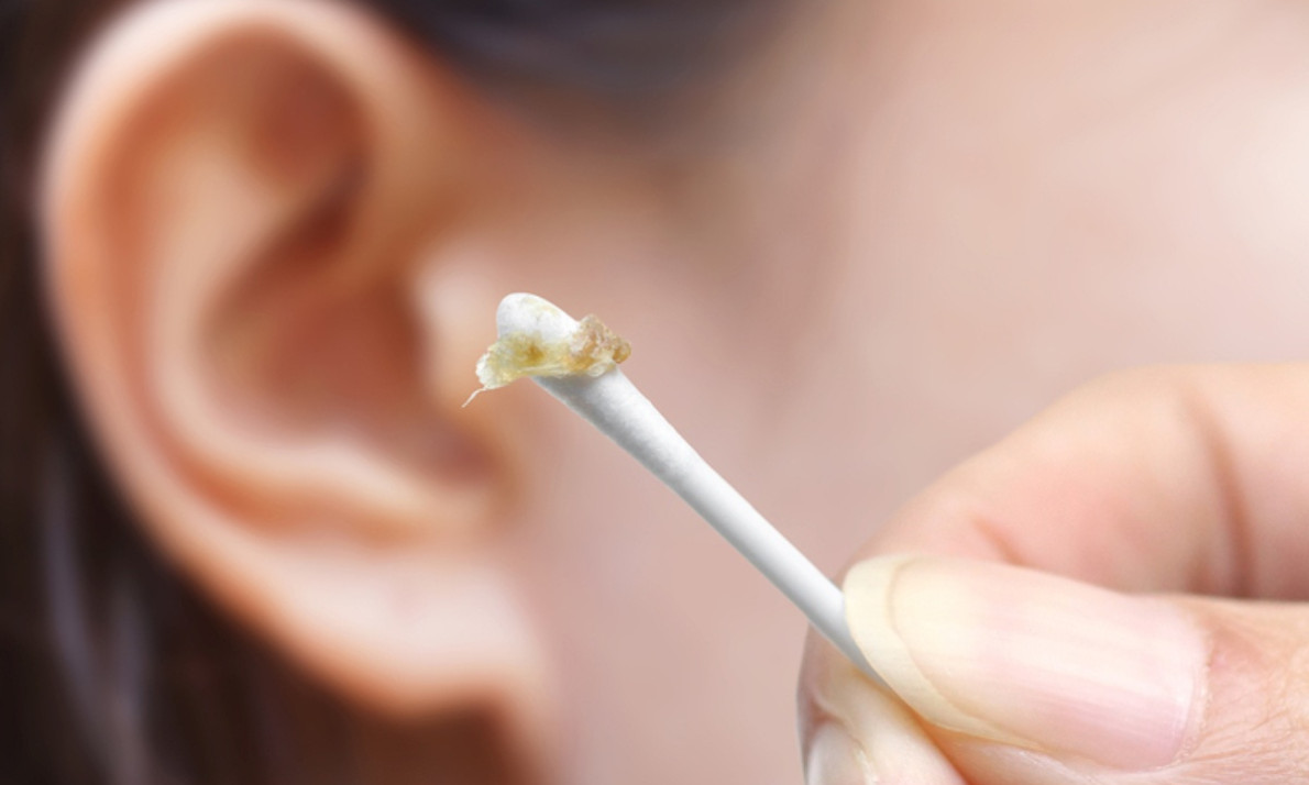 Αν καθαρίζετε τα αυτιά σας και δείτε αυτό τότε πρέπει να μιλήσετε με τον γιατρό σας (vid)