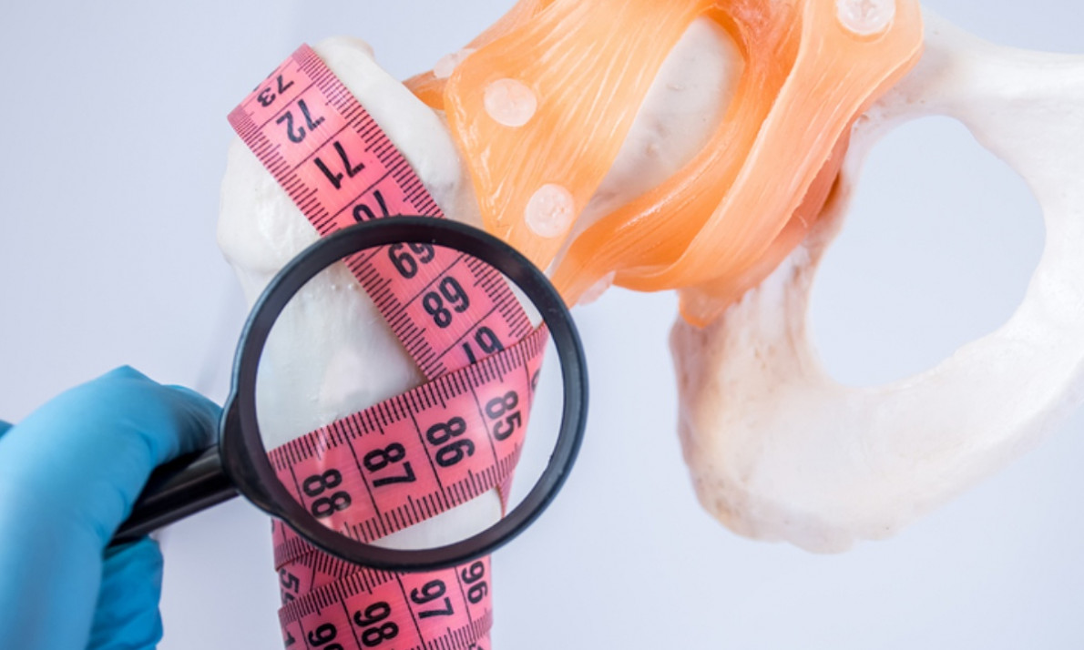 Οστεοπόρωση: Οι παράγοντες που αυξάνουν τον κίνδυνο (εικόνες)