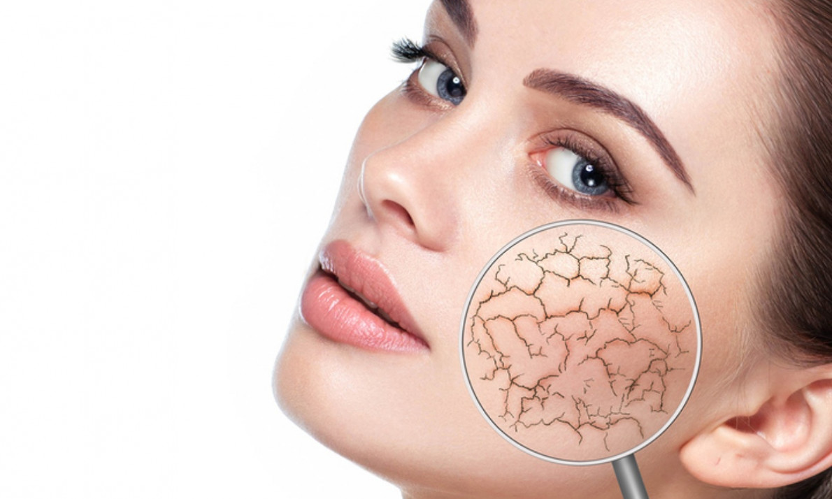 Ξηρή επιδερμίδα: 4 φυσικά υλικά για να την αντιμετωπίσετε (εικόνες)