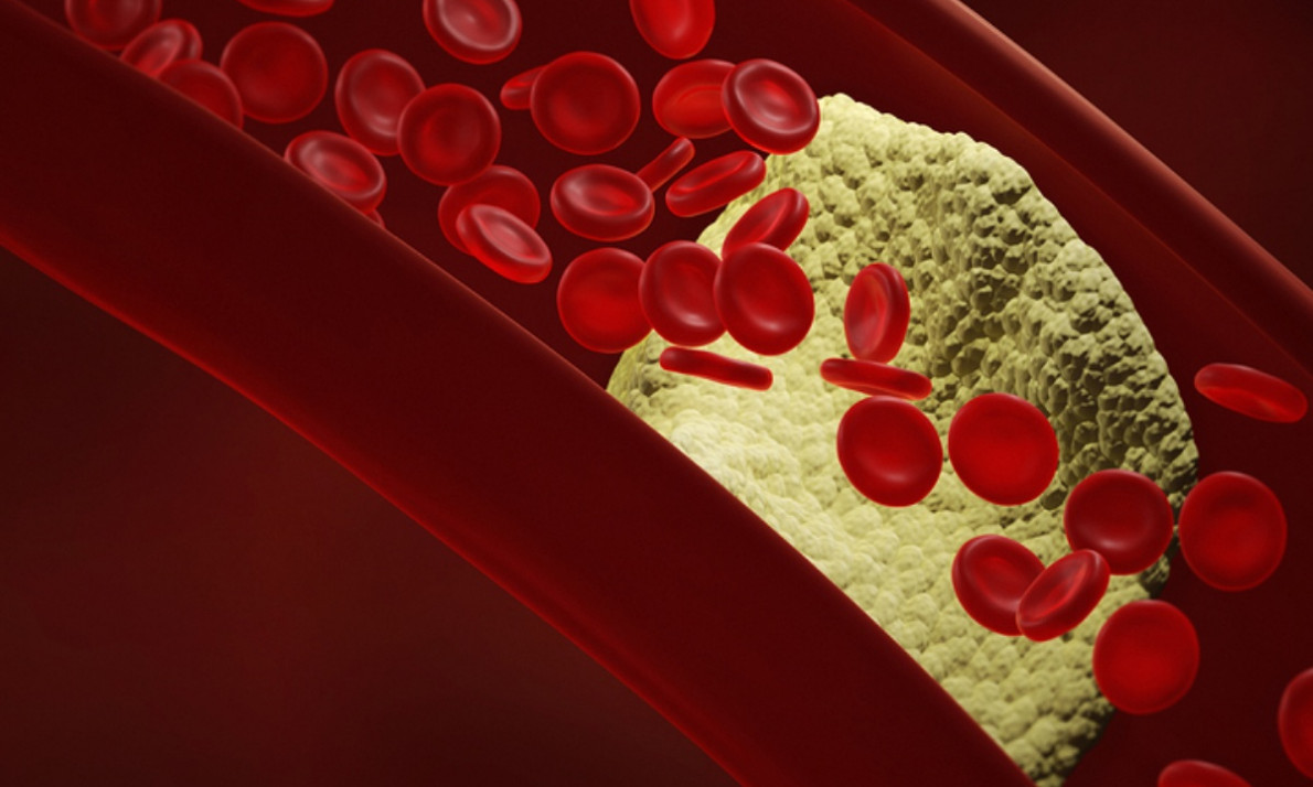 Πρόβλημα στην κυκλοφορία του αίματος: Τα σημάδια που δεν πρέπει να αγνοήσετε (εικόνες)