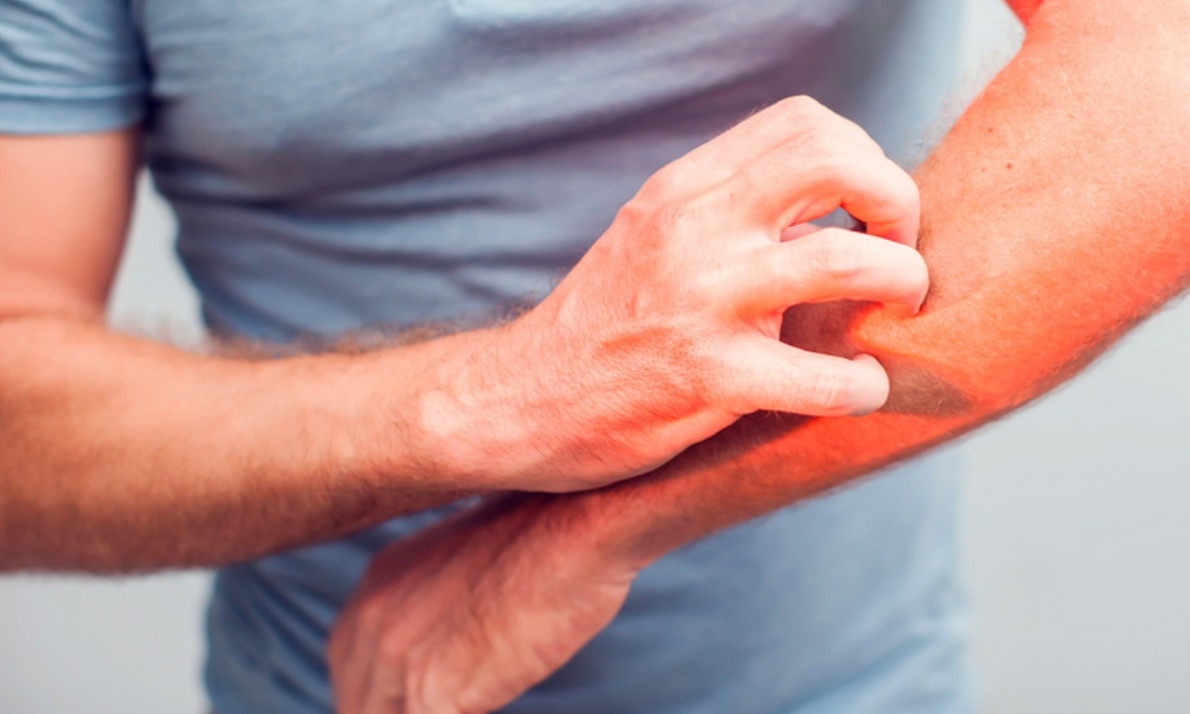 Δερματίτιδα: Αναγνωρίστε τα σημάδια μέσα από εικόνες