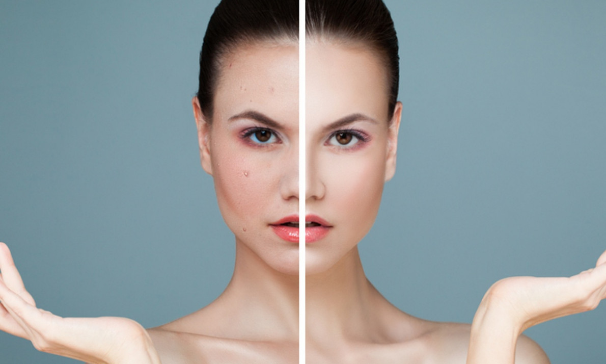 Δυσλειτουργία θυρεοειδούς: Με ποια δερματολογικά συμπτώματα εκδηλώνεται (εικόνες)