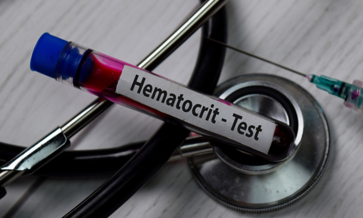 Χαμηλός αιματοκρίτης: Πού μπορεί να οφείλεται (εικόνες)