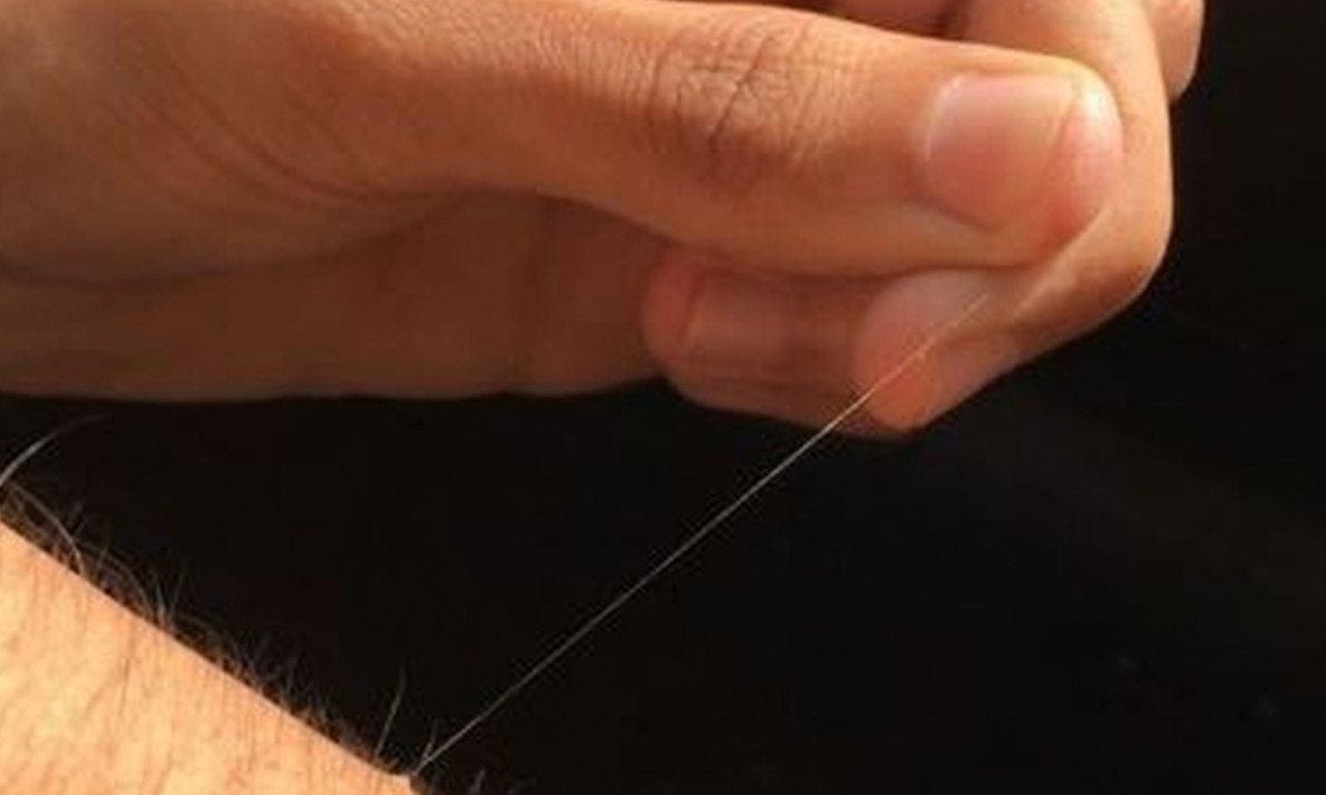 Γιατί κάποιες τρίχες στο σώμα σου μεγαλώνουν απίστευτα γρήγορα;