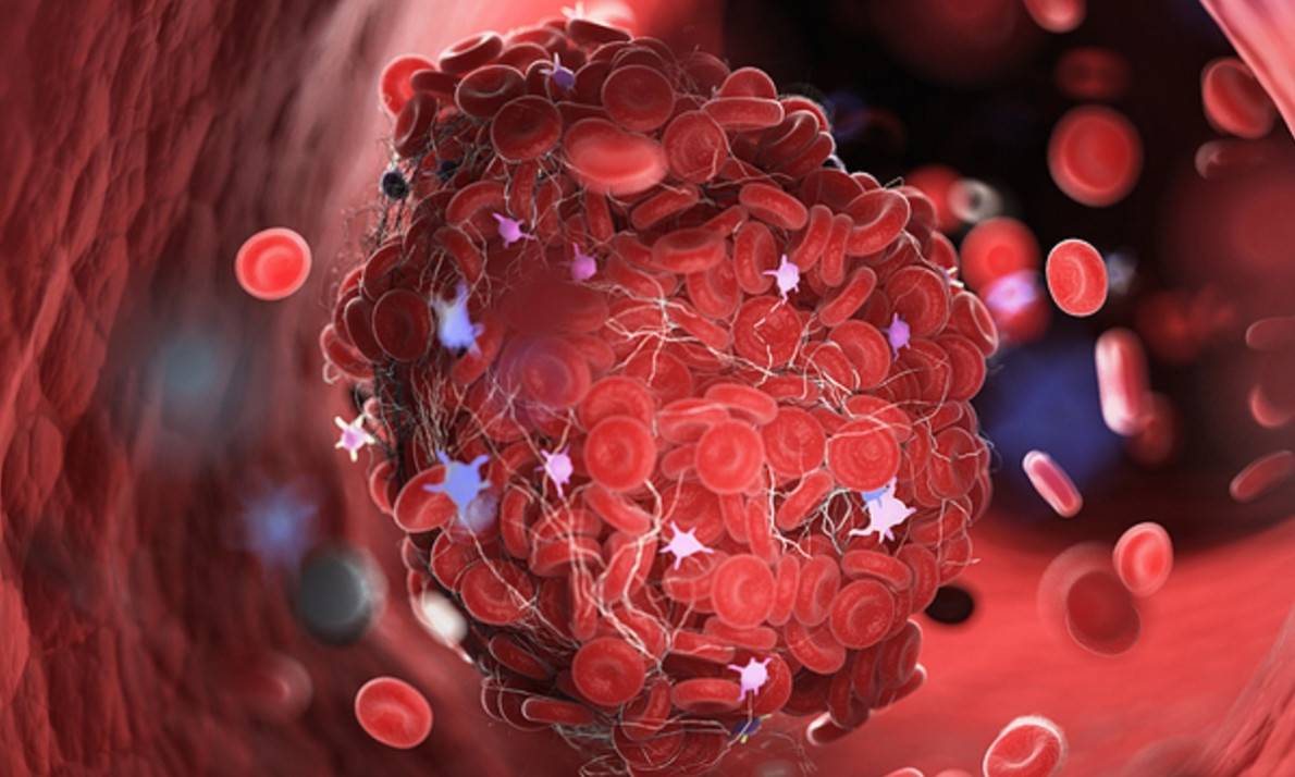 5 αιτίες κακής κυκλοφορίας του αίματος (βίντεο)