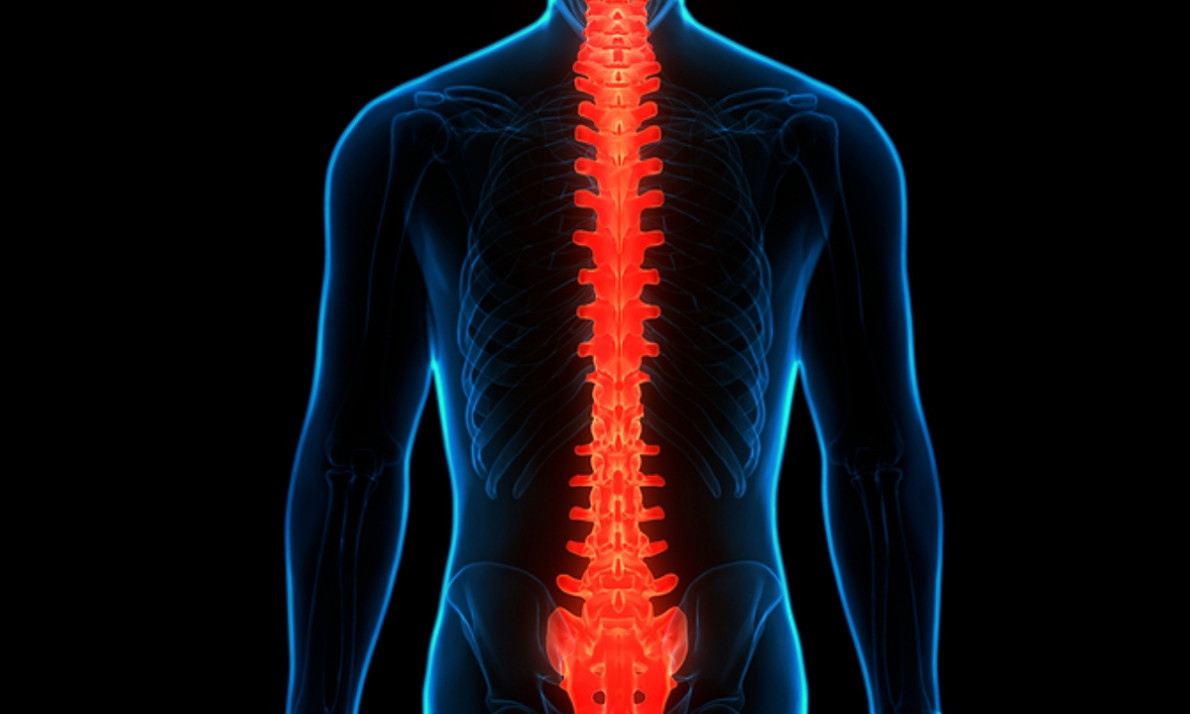 Νωτιαίο εγκεφαλικό επεισόδιο: Τι είναι και με ποια συμπτώματα εκδηλώνεται (εικόνες)