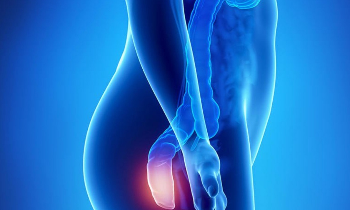 Ποιοι κινδυνεύουν περισσότερο από αιμορροϊδοπάθεια (εικόνες)