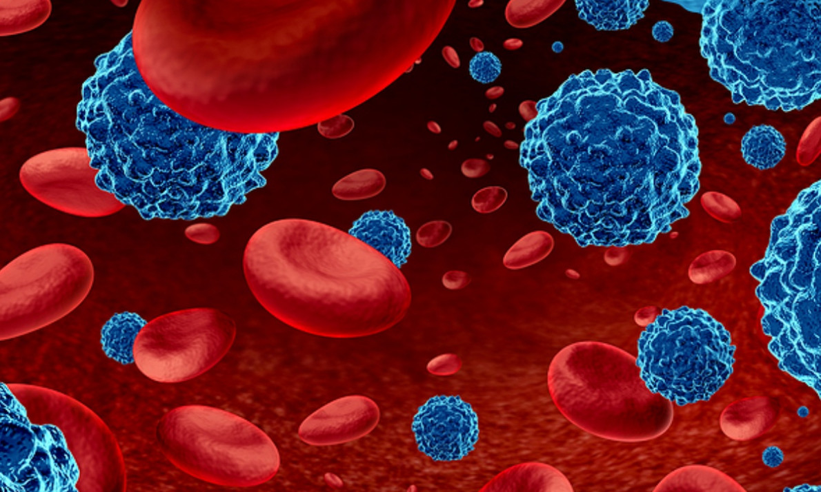 Λέμφωμα: Τα ύποπτα συμπτώματα που πρέπει να γνωρίζετε (εικόνες)