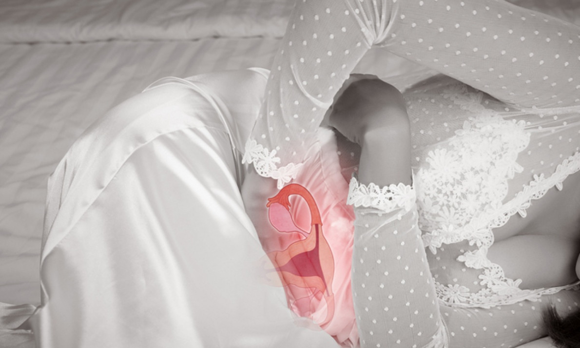 Καρκίνος ενδομητρίου: Οι 5 κυριότεροι παράγοντες κινδύνου