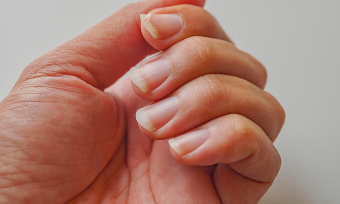Νύχια: Οι 7 καθημερινές συνήθειες που τα καταστρέφουν (pics)