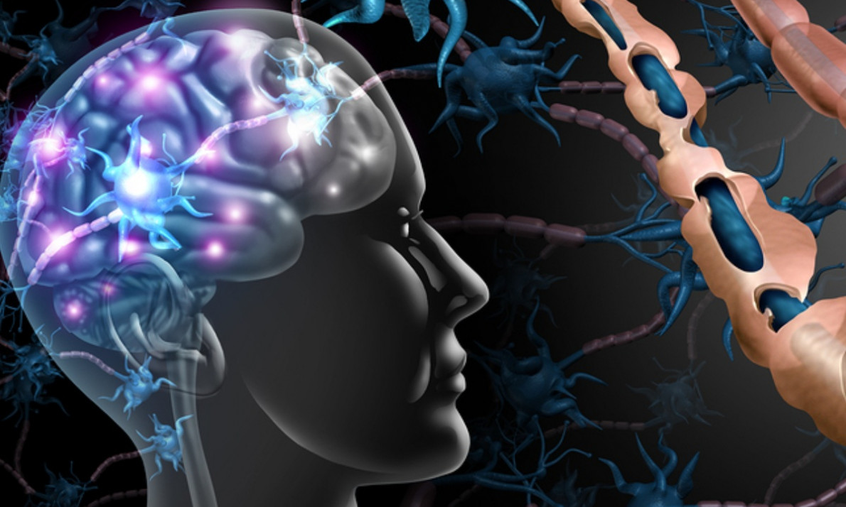 Σκλήρυνση κατά πλάκας: Οι παράγοντες που αυξάνουν τον κίνδυνο (εικόνες)