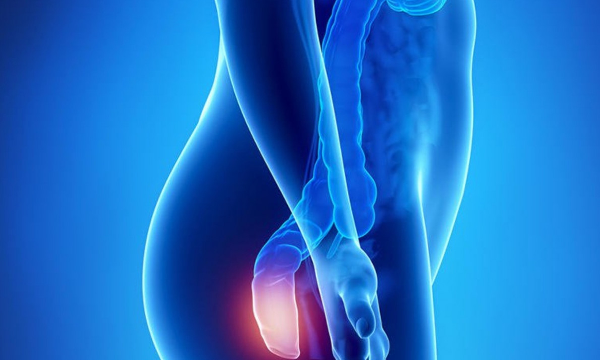 Ποιοι κινδυνεύουν περισσότερο από αιμορροϊδοπάθεια (εικόνες)