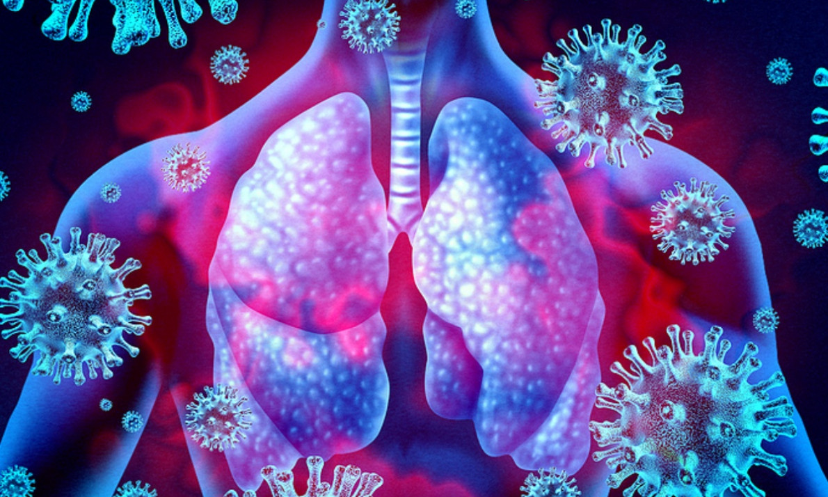 Πνευμονιοκοκκική νόσος: Τα συμπτώματα & ποιοι κινδυνεύουν περισσότερο (εικόνες)