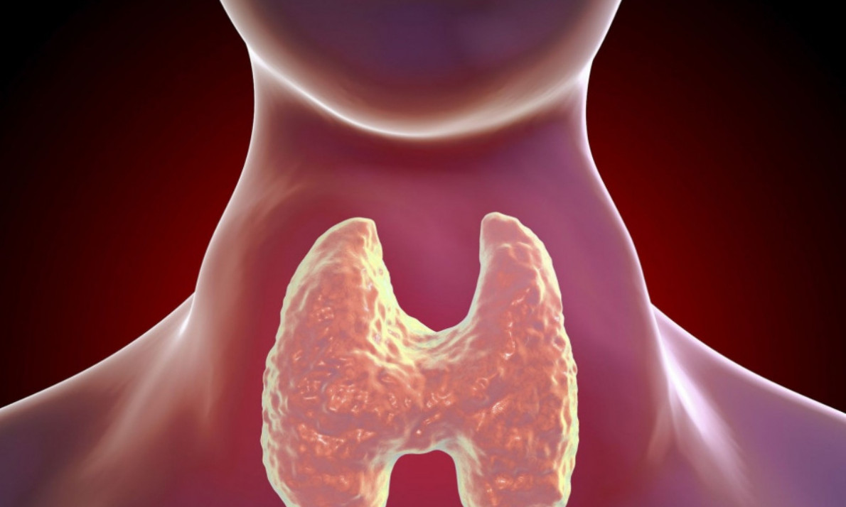 Νόσος του Graves: Οι παράγοντες που οδηγούν σε δυσλειτουργία του θυρεοειδούς (εικόνες)