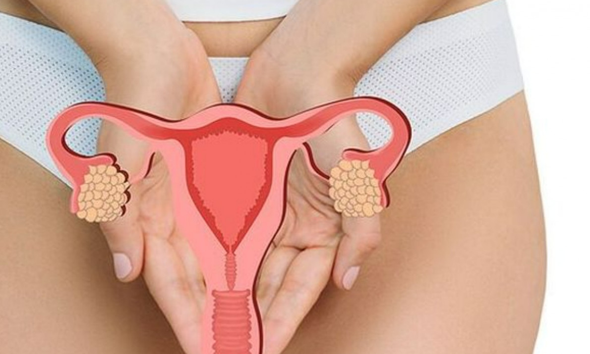 Υστερεκτομή: Τα είδη, οι λόγοι που επιβάλλεται, οι κίνδυνοι και ο χρόνος ανάρρωσης