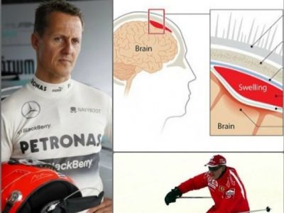 Michael Schumacher: Όλες οι λεπτομέρειες για το ατύχημα και το υποσκληρίδιο αιμάτωμα