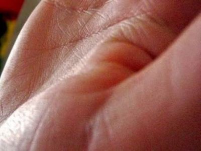 Το ΄ξερες; - Γιατί έχουμε γραμμές στις παλάμες μας;