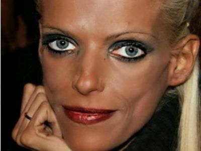 Μάχη με την ανορεξία: Δείτε πώς είναι σήμερα η Νανά Καραγιάννη