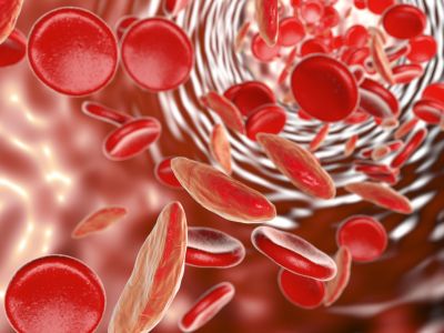 Αναιμία: 6 φρούτα που ενισχύουν την παραγωγή αιμοσφαιρίνης (φωτο)