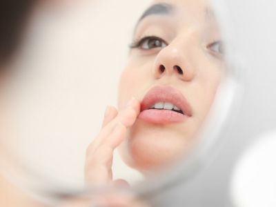 Άφθα ή επιχείλιος έρπης; Ξεχωρίστε τα μέσα από φωτογραφίες