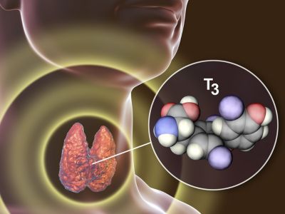Θυρεοειδίτιδα Χασιμότο: Με ποια συμπτώματα εκδηλώνεται (εικόνες)