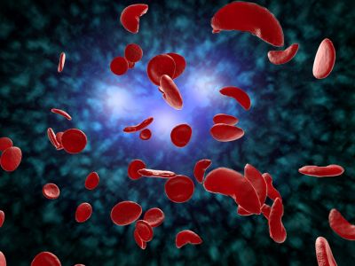 Αναιμία: Τι πρέπει να προσέξετε στη διατροφή σας (εικόνες)