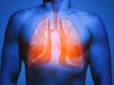 Οι τροφές που «καθαρίζουν» τους πνεύμονες (εικόνες)