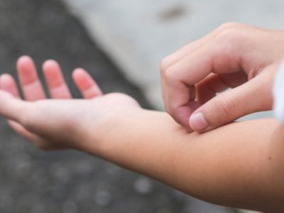 Φαγούρα στο δέρμα: 11 πράγματα που αποκαλύπτει για την υγεία (εικόνες)