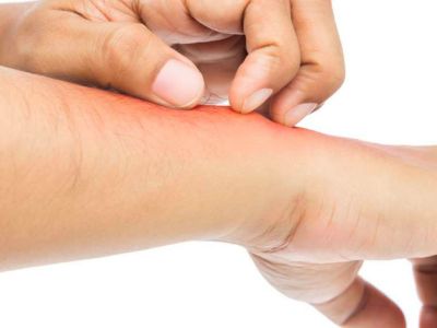 Δερματίτιδα από σαπούνι: Προσοχή σε αυτά τα αλλεργιογόνα (εικόνες)