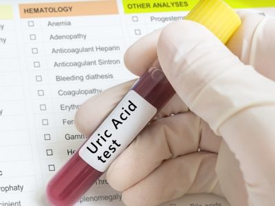 Ουρική αρθρίτιδα: Τα ύπουλα σημάδια που πιθανώς αγνοείτε (εικόνες)