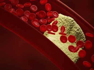 Πρόβλημα στην κυκλοφορία του αίματος: Τα σημάδια που δεν πρέπει να αγνοήσετε (εικόνες)