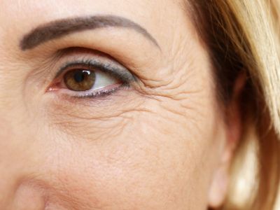 Ανεπάρκεια βιταμινών: Με ποια σημάδια εκδηλώνεται στο πρόσωπο (εικόνες)