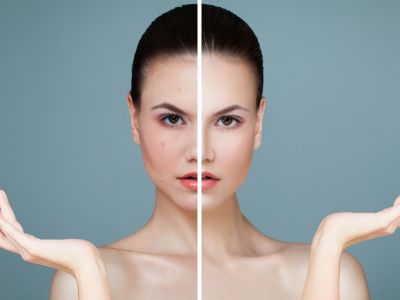 Δυσλειτουργία θυρεοειδούς: Με ποια δερματολογικά συμπτώματα εκδηλώνεται (εικόνες)