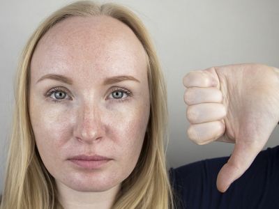 Λιπαρή επιδερμίδα: Οι παράγοντες που την επιδεινώνουν (εικόνες)