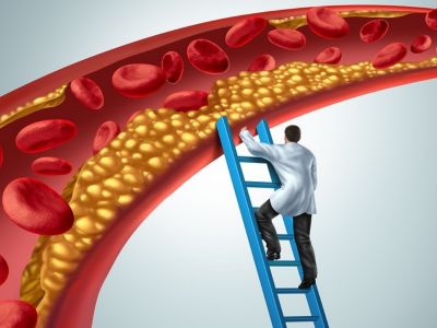 Στένωση αρτηριών: Τι να τρώτε και τι να αποφεύγετε (εικόνες)