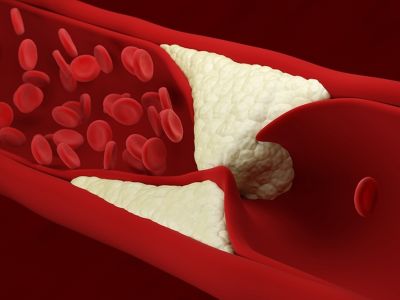 Πρόβλημα στην κυκλοφορία του αίματος: Τα ορατά σημάδια (εικόνες)