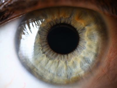 Αποκόλληση αμφιβληστροειδούς: Οι βασικοί παράγοντες κινδύνου σε εικόνες