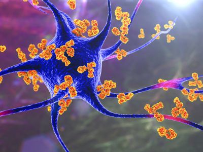 Σκλήρυνση κατά πλάκας: Οι τροφές που βοηθούν στην πρόληψη της νόσου (εικόνες)