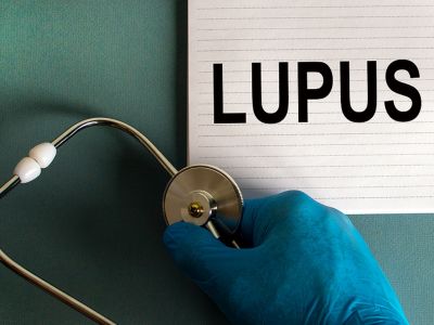 Λύκος: Τι πρέπει να προσέχετε στη διατροφή (εικόνες)