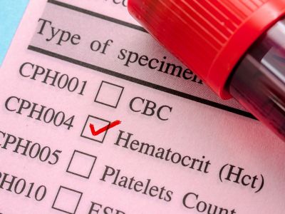 Χαμηλός αιματοκρίτης: Οι πιθανές αιτίες σε εικόνες