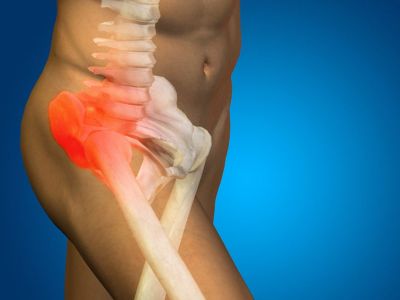 Οστική υγεία: Σημάδια ότι τα οστά σας κινδυνεύουν (εικόνες)