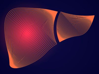 Λίπος στο συκώτι: Πώς θα προστατευθείτε από τις σοβαρές επιπτώσεις (εικόνες)