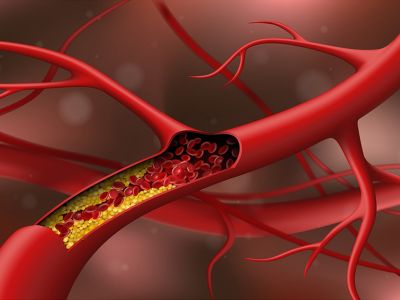 Οι 7 τροφές που μειώνουν τα επίπεδα της χοληστερίνης (βίντεο)