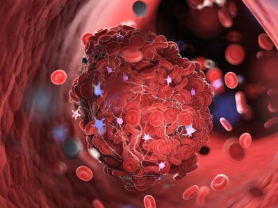 5 αιτίες κακής κυκλοφορίας του αίματος (βίντεο)