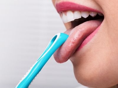Γιατί πρέπει να βουρτσίζετε τη γλώσσα σας (εικόνες)