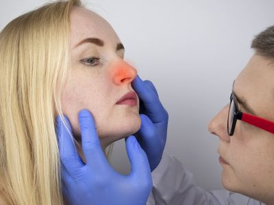 Κρεατάκια στη μύτη: Ποιες είναι οι πιθανές επιπτώσεις (εικόνες)