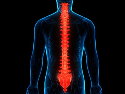 Νωτιαίο εγκεφαλικό επεισόδιο: Τι είναι και με ποια συμπτώματα εκδηλώνεται (εικόνες)