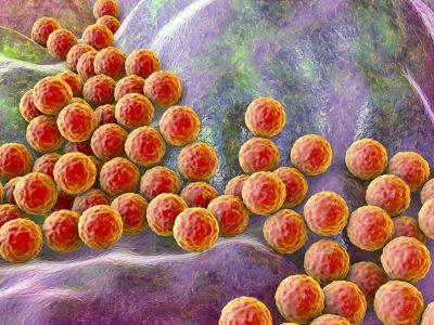 Σταφυλόκοκκος: Ποιοι είναι οι συχνότεροι τρόποι μετάδοσης (εικόνες)