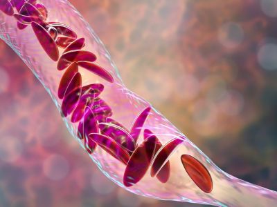 Χαμηλός αιματοκρίτης: 12 τροφές για να τον ενισχύσετε (εικόνες)