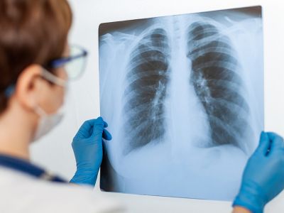 Γήρανση πνευμόνων: Οι βασικοί παράγοντες κινδύνου (εικόνες)